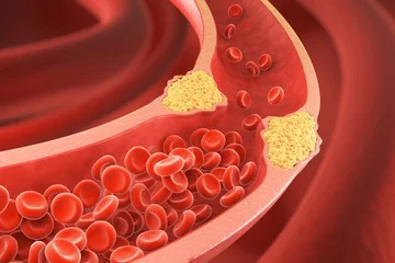 tvSPHTucW_360x240__1