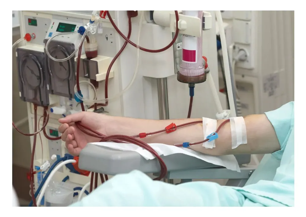 Dialysis-_-hemodialysis-_-Britannica_pages-to-jpg-0001-1