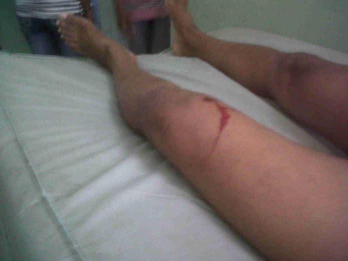 Baleado-rodilla-696x522