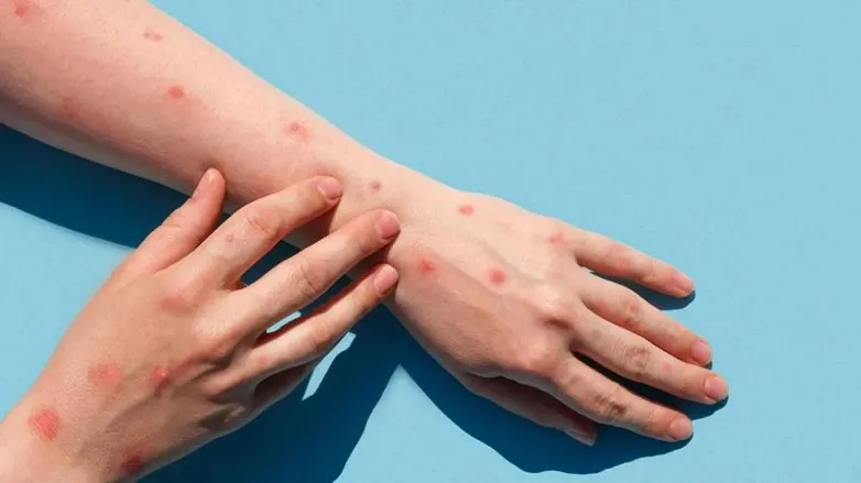 8a351b8a5007d22998f7e971afbb4166_L