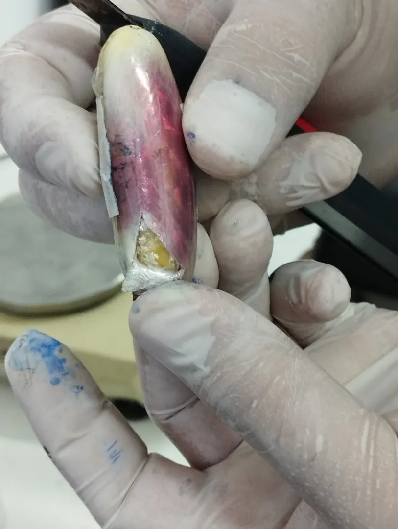 ingieren_adosan_y_transportan_338_capsulas_con_cocaina_4